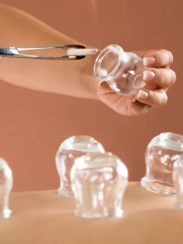 Book Cupping Therapy Session